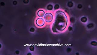 Blood Monocyte consuming the yeast Candida 1