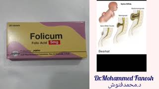 Folic acid and fetal abnormalities  حمض الفوليك و تشوهات الجنين😥👶