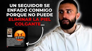 ¿Cómo quitar la piel colgada? 💉 (Gana autoestima, confianza y ayuda a los demás)