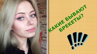 Виды брекет систем и их материалы / ЛИЧНЫЙ ОПЫТ