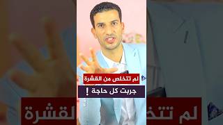 حل طبيعي للتخلص من قشرة الشعر والجسم  #اكسبلور #صحه#شامبو #الشعر #القشرة