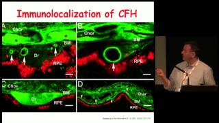 Lecture 20: Dr Imre Lengyel, Zinc in the eye and the visual pathway