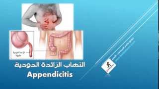 appendicitis - التهاب الزائدة الدودية