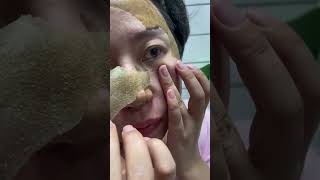 Skin Breakthrough: Unveiling the Best Face Mask for Whiteheads and Blackheads! #shorts #foryou