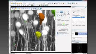 Webinar: Automatic neuron reconstruction/analysis with Neurolucida 360