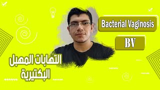 BV | 5 علاجات موثوقة  لالتهاب المهبل البكتيري