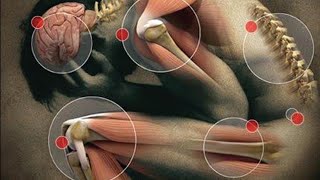 ИСЦЕЛИТЬСЯ ОТ ПОДАГРЫ ...ДЛЯ ВСЕХ .ИНГА ХОСРОЕВА.