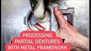 PARTIAL DENTURE PROCESSING #WAXBAE #DENTURE #PARTIALDENTURES