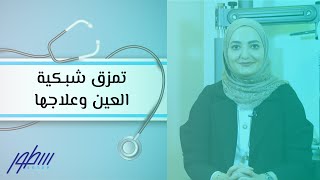 تمزق شبكية العين وعلاجها