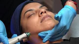 The Process Of A Hydra Facial Procedure! (Dermoplane) Blue Diamond Med Spa