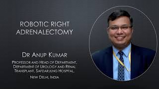 Robotic Right #Adrenalectomy #Adrenal Gland Removal #Surgery by Dr Anup Kumar, Safdarjung Hospital