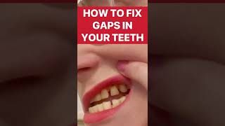 #shorts How to close gaps in your teeth