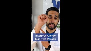 How to Understand Your Allergy Skin Test Results #shorts