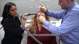 Botox Demonstration 30 Upper Face - A E Skin - Encino, CA - 818-835-1833