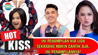 NIA LIDA LIVE! Ini penampilan Nia lida sekarang makin cantik aja,gini penampilannya?