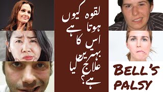 Bell's palsy Urdu video