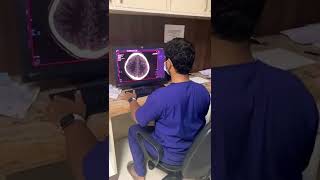 Medical college The X-ray doctor , neetPG motivation #neetpg #shorts #radiology #mbbs