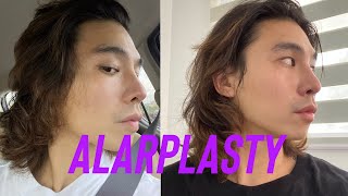 ALARPLASTY at The Icon Clinic with Doc Yappy | JEFF ONG