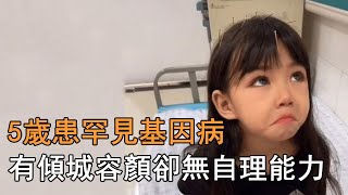 「失聲天使」藍妮妮：5歲患罕見基因病，有傾城容顏卻無自理能力