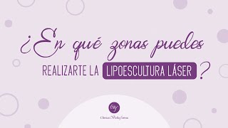 ¿En qué zonas puedes realizarte la lipoescultura láser? 🤔🤔 Clínica Bellaforma