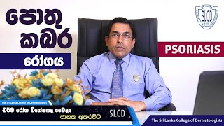 Psoriasis (පොතු කබර) - Dr. Janaka Akarawita, Consultant Dermatologist #skincare #dermatology