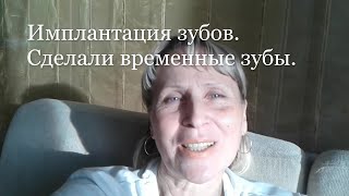 4. Импланты приживаются/ Сделали временные зубы.