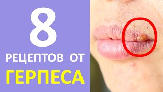 Герпес на губах народные средства лечения | А рецепт?