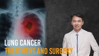 Lung cancer surgery and treatment