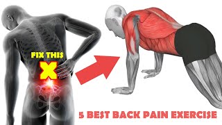 Top 5 Best Exercise For Back Pain | What is Best Exercise For Lower Back pain | Back Pain Exercises