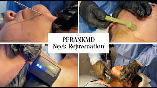 PFRANKMD Neck Rejuvenation with Microneedling | Treating the Neck, Jowls, and Jawline