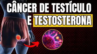 CÂNCER DE TESTÍCULO: PODE FAZER REPOSIÇÃO DE TESTOSTERONA?