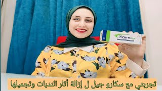 سكارو جيل لازالة اثار الجروح والندبات والحفر