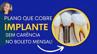 Plano odonto que cobre implante! Atualizado! Sem carência e no boleto para CNPJ!