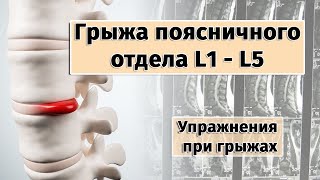 Здоровый позвоночник. Упражнения при грыже поясничного отдела.