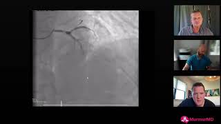 How would you handle this severe coronary calcium case?! #cardiology