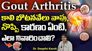 Gout Causes Symptoms And Treatments | గౌట్ - తగ్గించుకునే మార్గాలు || Dr. Deepthi Kareti