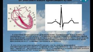 Фактор внезапной смерти: укороченный интервал P-Q. Воробьев Л.В.