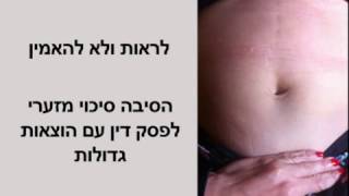 חוות דעת - המיקצוע פלסטיקאי | הפרנסה חוות דעת | חוות דעת הזויה | חוות דעת רשלנית