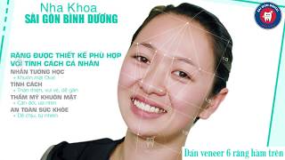 Chị Yến Nhi Dán Veneer 6 Răng Đẹp Lung Linh tại Nha Khoa Sài Gòn Bình Dương