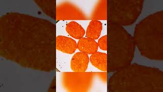 #chickennuggets#recipe#viralvideo#viral#video#shortvideo#youtubeviralshortvideo#reels#shorts#short