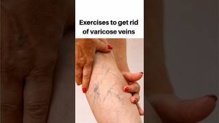 Varicose vein exercise kaise kare|#shorts #varicose vein#