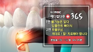 [메디컬다큐365] 불가능은 없다 임플란트 뼈이식 / 무릎부상, 제대로! 잘! 치료해야 합니다.  (23.09.11 예고편)