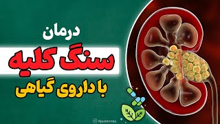 درمان سنگ کلیه با داروی گیاهی || با فرمول طب سنتی چطور از سنگ کلیه خلاص بشیم؟