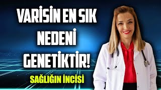 VARİS NEDEN OLUŞUR ? / Op.Dr. Çiğdem ACİL / (#sağlığınincisi) #27