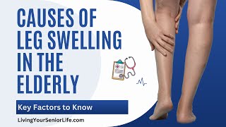 Uncovering Key Causes of Leg Swelling in the Elderly