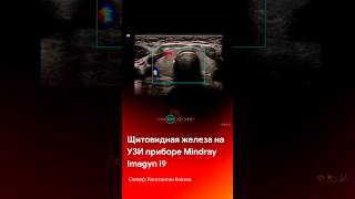 Щитовидная железа на приборе Mindray Imagyn i9 #shorts #short #tiktok #reels #medical #узи #медицина