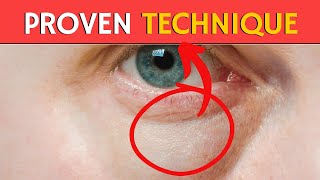 Get Rid of Puffy Eyes – Proven Techniques