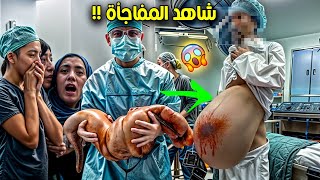 شاهد ماذا وجدوا في بطن هذا الرجل أكل كبد ارنب اسود فحدث له شيء صدم الملايين؟ سبحان الله !!