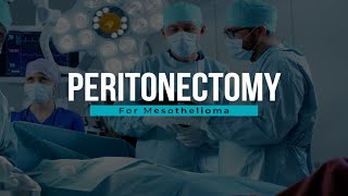 Peritonectomy for Mesothelioma | Mesothelioma Hope