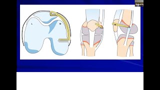 Patellar Instability in Adolescents and MPFL Reconstruction: Shital Parikh MD